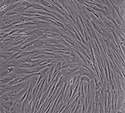 Read more about the article Are Mesenchymal Stem Cells (MSCs) better than Induced Pluripotent Stem Cells (iPSCs)?