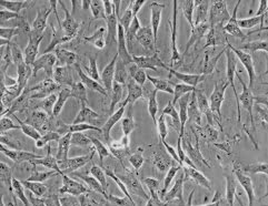 You are currently viewing A Simple Approach To Culture Patient-Specific Fibroblasts