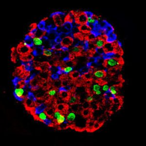 Read more about the article Pancreatic Islets – An Important Tool For Diabetes Research