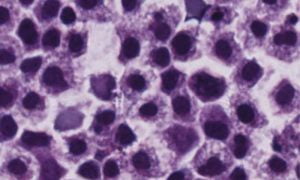 Read more about the article Blood Stem Cell Subset Therapeutically