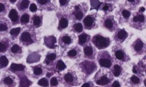 Read more about the article Blood Stem Cell Subset Therapeutically