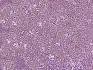 Read more about the article Human Umbilical Cord-Derived Endothelial Cells (HUVECs) – Your Right Choice for Vascular Research