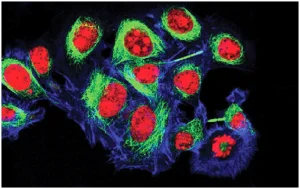 Read more about the article Points To Remember Before Ordering Cells