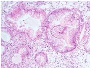 Read more about the article Using Primary Cultures To Assess Toxicity In Kidneys And Study Cancer