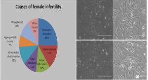 Read more about the article Culturing The Endometrial Cells To Assess Cancers And Reproductive Biology