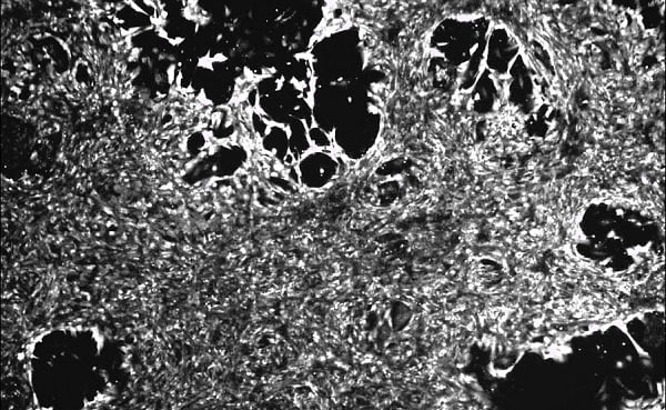 You are currently viewing Primary Cultures To Study Cardiomyocytes Biology