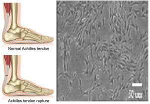 Read more about the article Culturing Cells From The Tendon To Address Tendon Damage