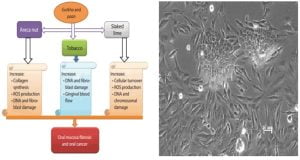 Read more about the article Establishing A Carcinoma Culture For Studying Changes In The Notorious Oral Cancer