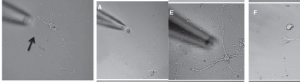 Read more about the article Primary Cultures From Brain Surgery Samples To Study The Nervous System