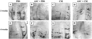 Read more about the article Adipose Mesenchymal Stem Cells For Healing