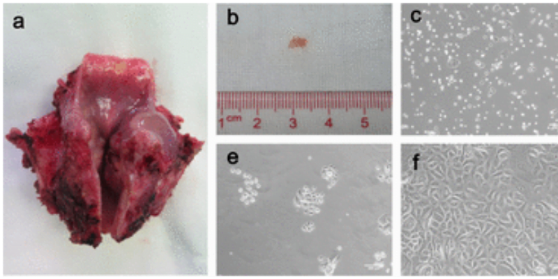 You are currently viewing Culturing Cells Of The Larynx To Heal The Throat