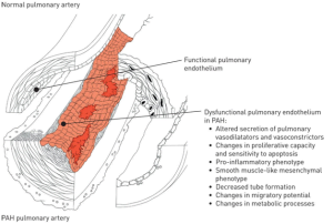 Read more about the article Culturing Lung Endothelial Cells To Target Pulmonary Hypertension And Acute Lung Injury