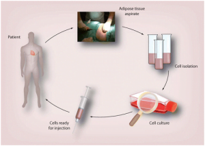 Read more about the article Mesenchymal Stem Cells From Adipose Tissue Weave Their Magic