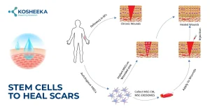 Read more about the article Stem Cells To Heal Scars