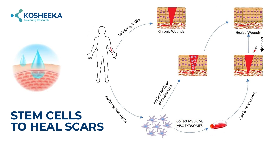 You are currently viewing Stem Cells To Heal Scars