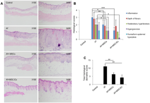 Read more about the article The Therapeutic Prowess Of Human Umbilical Cord-Derived Mesenchymal Stem Cells
