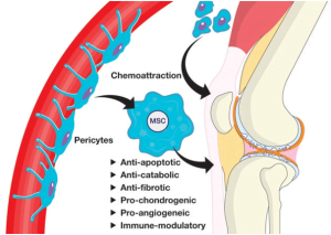 Read more about the article Mesenchymal And Adipose Stem Cells For Osteoarthritis
