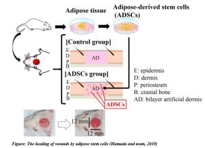 Read more about the article Adipose stem cells for the skin
