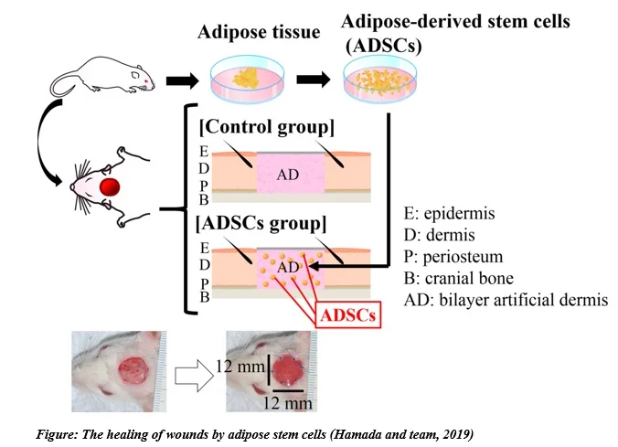You are currently viewing Adipose stem cells for the skin