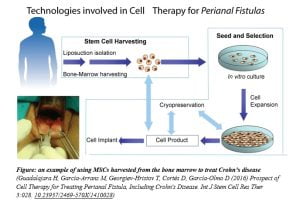 Read more about the article Mesenchymal Stem Cells for the Treatment of Crohn’s disease