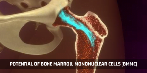 Read more about the article The Potential Of Bone Marrow Mononuclear Cells (BMMC)