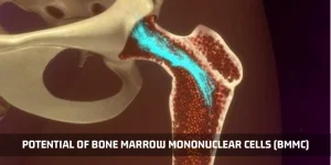 Read more about the article The Potential Of Bone Marrow Mononuclear Cells (BMMC)
