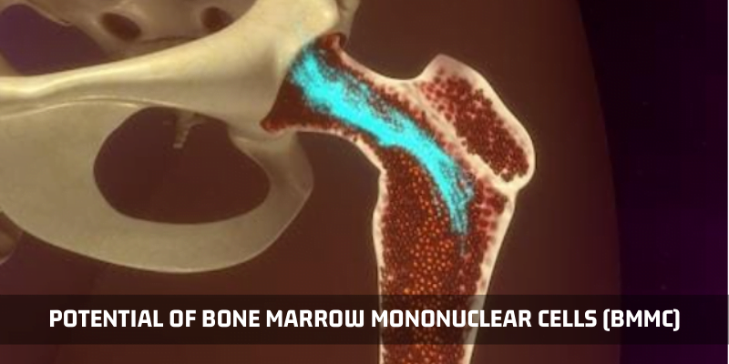 You are currently viewing The Potential Of Bone Marrow Mononuclear Cells (BMMC)