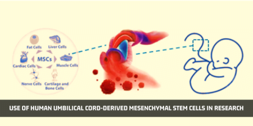Curated visual reference: Fresh Look at Use Of Human Umbilical Cord Derived Mesenchymal Stem Cells In