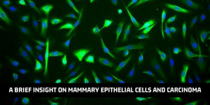 Read more about the article A Brief Insight On Mammary Epithelial Cells And Carcinoma