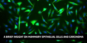 Read more about the article A Brief Insight On Mammary Epithelial Cells And Carcinoma