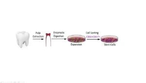 Read more about the article Human Dental Mesenchymal Stem Cells and Neural Regeneration