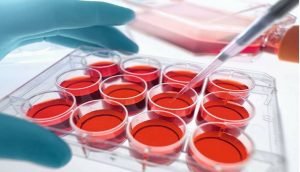 Read more about the article Human Umbilical Cord Blood for Progenitor Cell Transplant