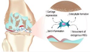 Read more about the article Mesenchymal Stem Cells in Osteoarthritis