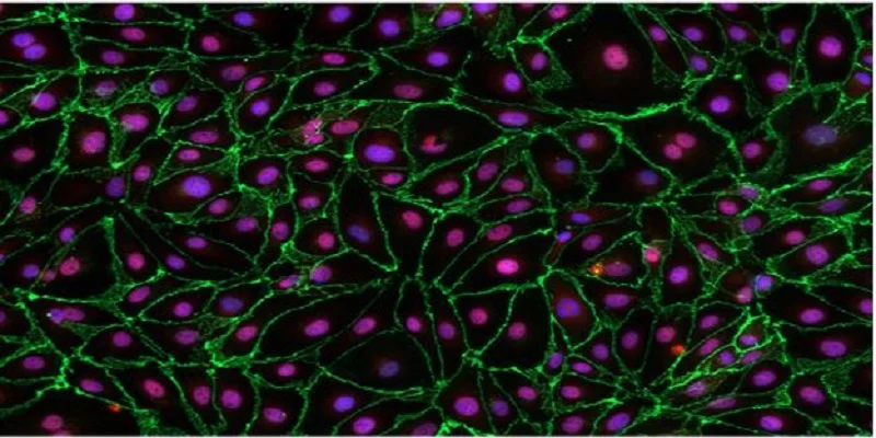 You are currently viewing Advantages and Disadvantages of Using Primary Cells in Cell Culture