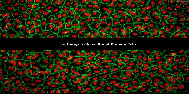 You are currently viewing 5 Things to Know about Primary Cells