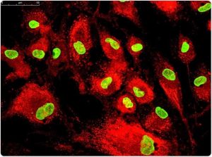 Read more about the article Human Mesenchymal Stem Cells: Can Fat Make You Healthier?