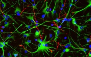 Read more about the article Adult Neural Progenitor Cells | Kosheeka