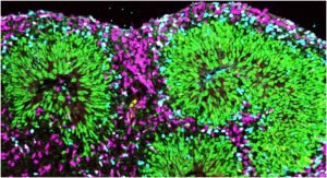 Read more about the article Organoids- Advanced 3D Cell Culture