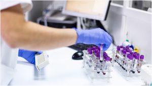 Read more about the article Diabetes Research- Which Metabolic Processes to Target?