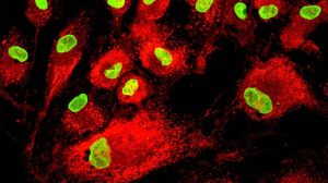 Read more about the article Mesenchymal Stem Cells- Potential Therapeutic Applications of MSCs