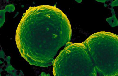 You are currently viewing Things that we still don’t know about primary cells