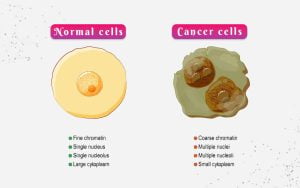 Read more about the article Normal Cells vs. Cancer Cells
