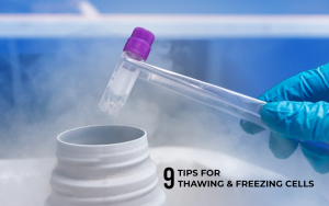 Read more about the article 9 Tips for Thawing and Freezing Cells