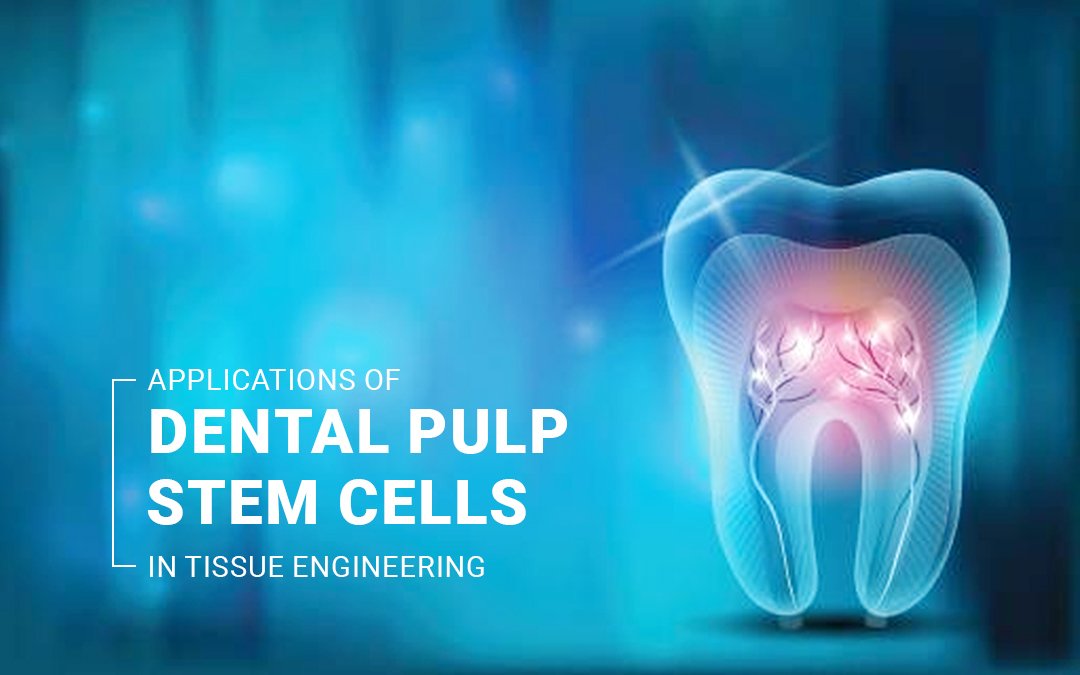 You are currently viewing Applications of Dental Pulp Stem Cells in Tissue Engineering