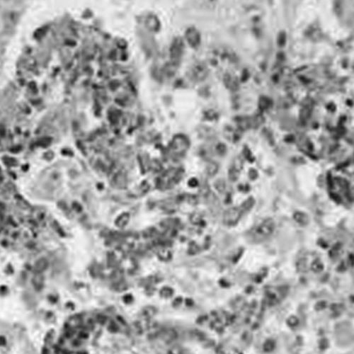 You are currently viewing Culturing Interesting Cells Called Pericytes