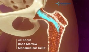 Read more about the article All About Bone Marrow Mononuclear Cells!