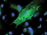 Human Umbilical Cord Blood Derived CD34+ Cells