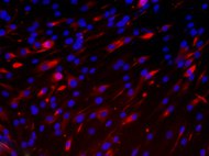 Human Skin Derived Dermal fibroblasts Adult