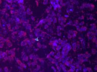 Human Endometrial Epithelial Cells