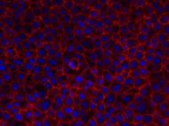 Human Skin Derived Epidermal Keratinocytes Adult